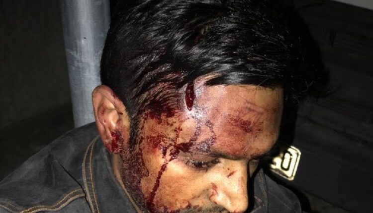 Ρατσιστική επίθεση στα Καμίνια