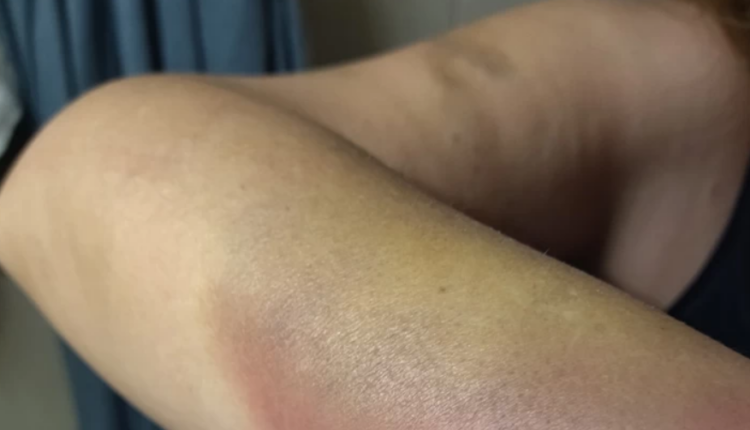 Επίθεση ανηλίκων σε ζευγάρι