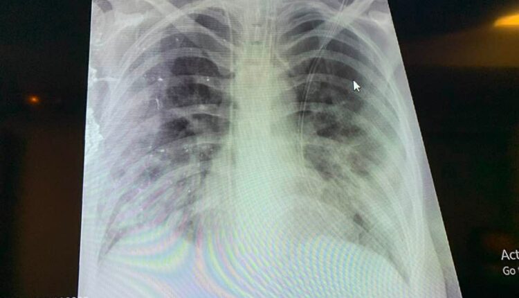 Ακτινογραφία εγκύου