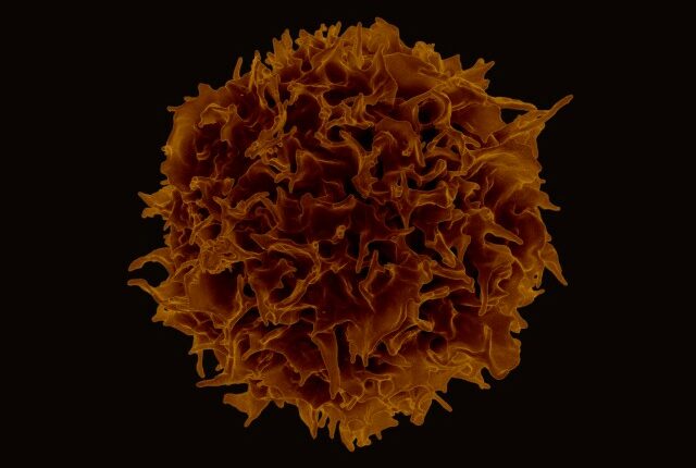 Τ- Λεμφοκύτταρο