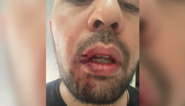 ΠΑΠΑΔΟΠΟΥΛΟΣ