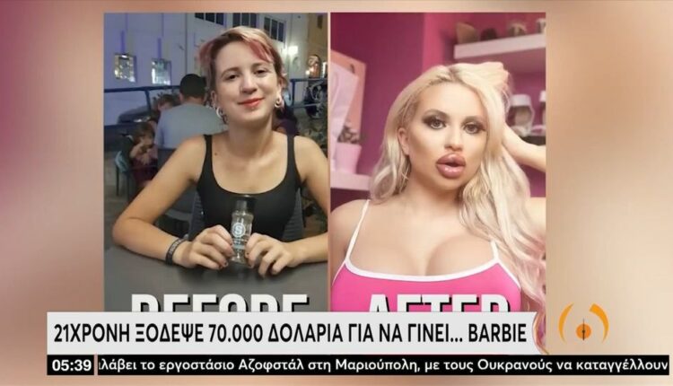 21χρονη Γερμανίδα έγινε Barbie