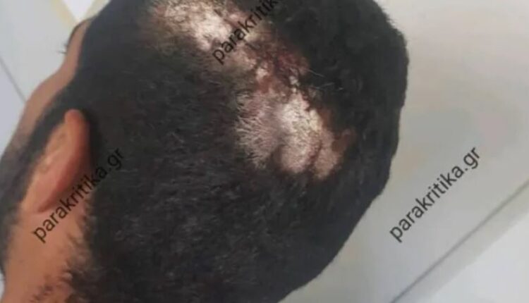 Επίθεση στα Χανιά